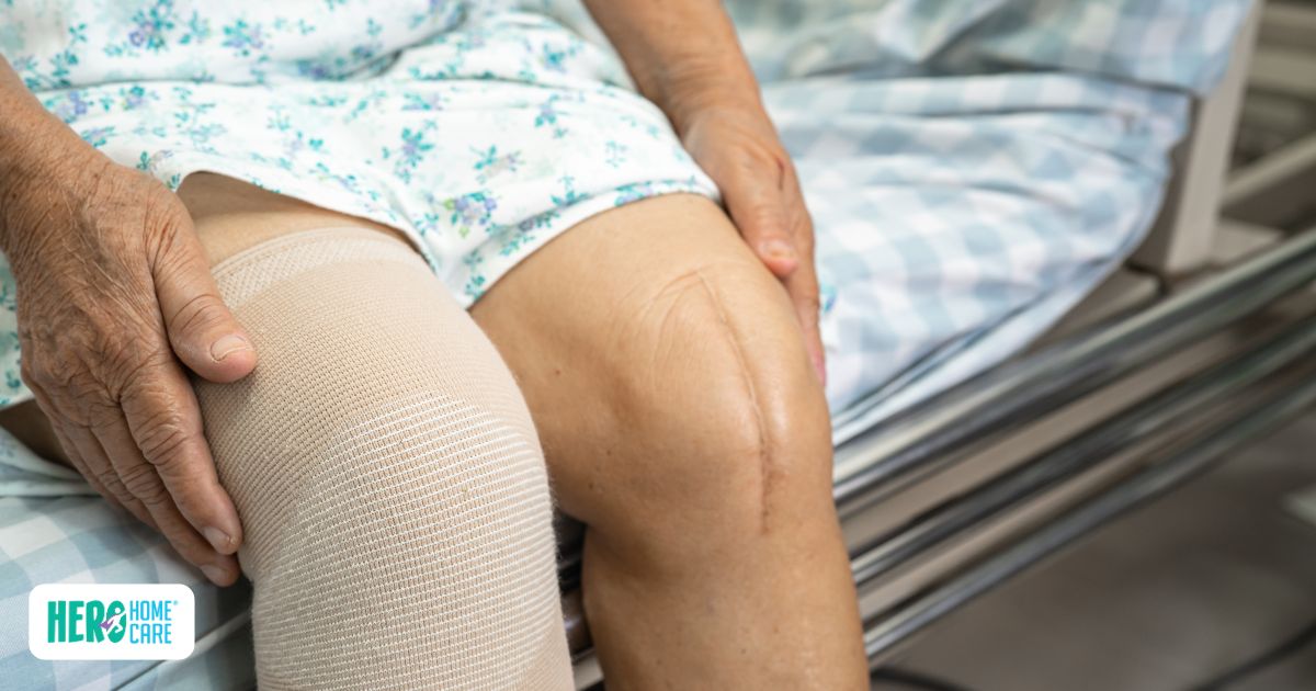 Senior recovering from knee replacement surgery with a surgical incision and compression bandage, illustrating a common procedure that often requires home care support during recovery